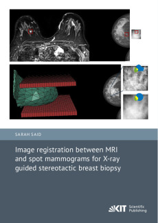 Image registration between MRI and spot mammograms for X-ray guided stereotactic breast biopsy