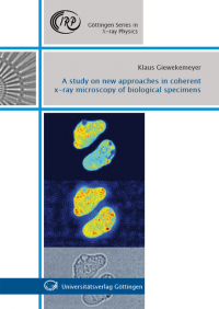 A study on new approaches in coherent x-ray microscopy of biological specimens