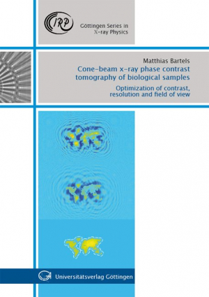 Cone-beam x-ray phase contrast tomography of biological samples