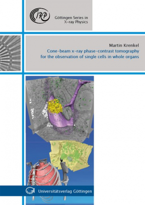 Cone-beam x-ray phase-contrast tomography for the observation of single cells in whole organs