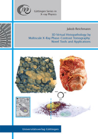 3D Virtual Histopathology by Multiscale X-Ray Phase-Contrast Tomography: Novel Tools and Applications