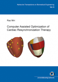 Computer assisted optimization of cardiac resynchronization therapy