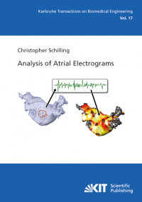 Analysis of Atrial Electrograms